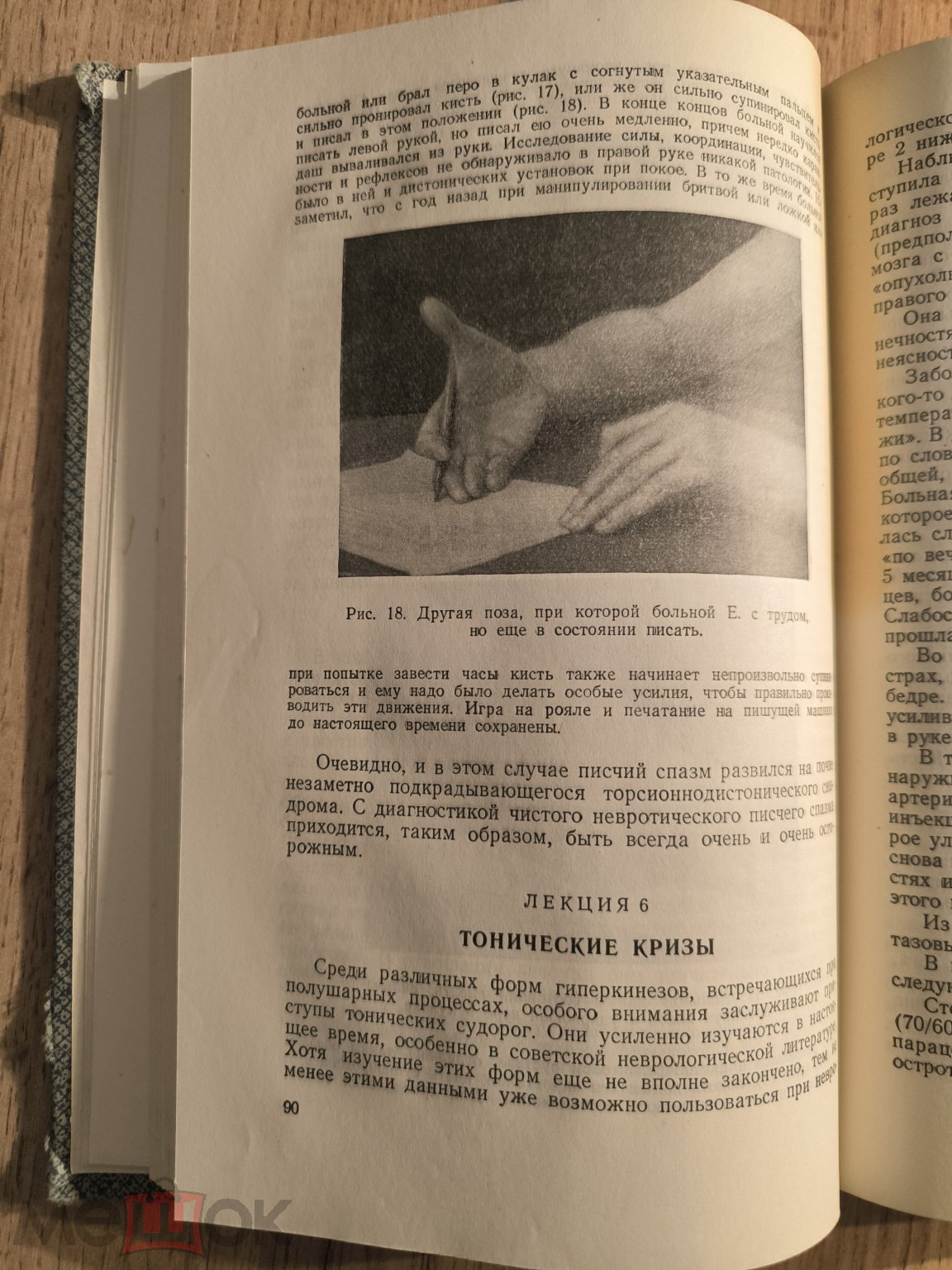 Клинические лекции по нервным болезням 1956 С. Н. Давиденков